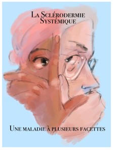 Titre BD Sclérodermie Systémique