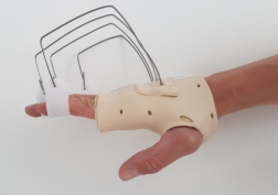 Orthèse de fonction pour une main sclérodermique