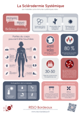 Infographie sclérodermie systémique